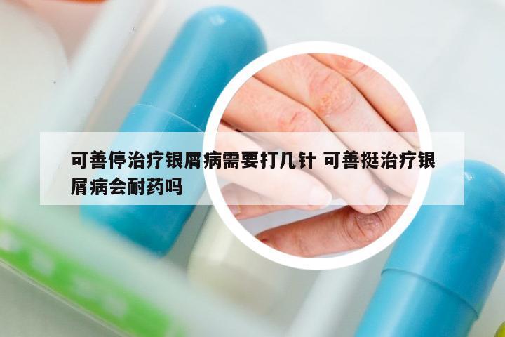 可善停治療銀屑病需要打幾針 可善挺治療銀屑病會(huì)耐藥嗎