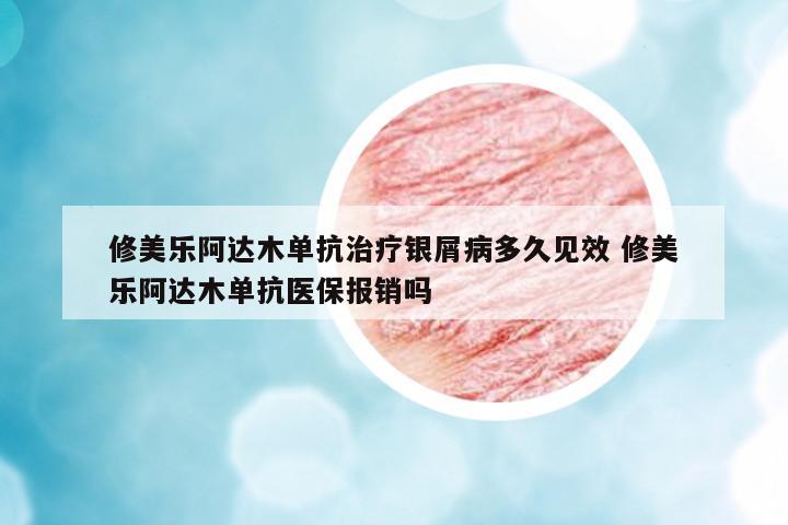 修美樂(lè)阿達(dá)木單抗治療銀屑病多久見(jiàn)效 修美樂(lè)阿達(dá)木單抗醫(yī)保報(bào)銷嗎