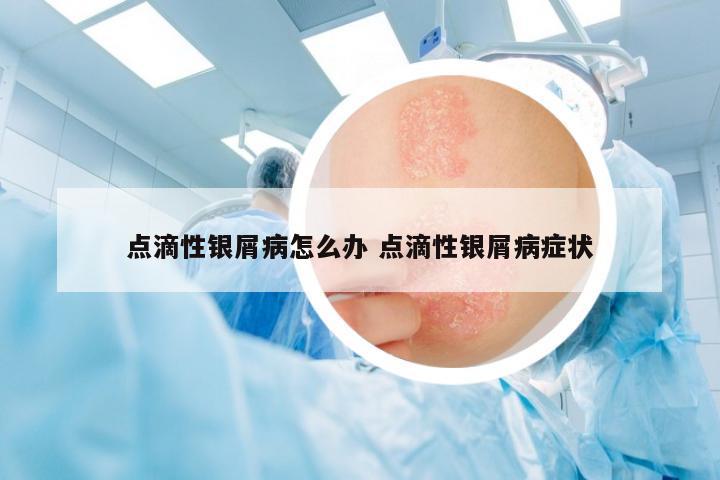 點滴性銀屑病怎么辦 點滴性銀屑病癥狀