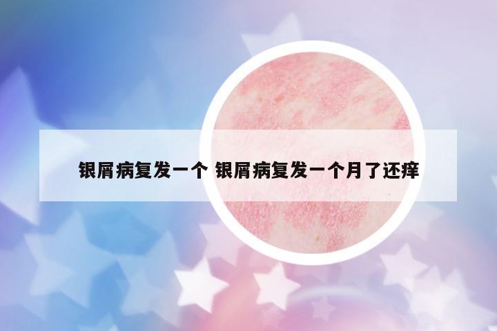 銀屑病復(fù)發(fā)一個 銀屑病復(fù)發(fā)一個月了還癢