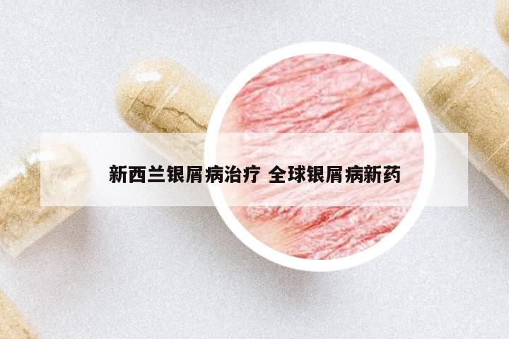 新西蘭銀屑病治療 全球銀屑病新藥
