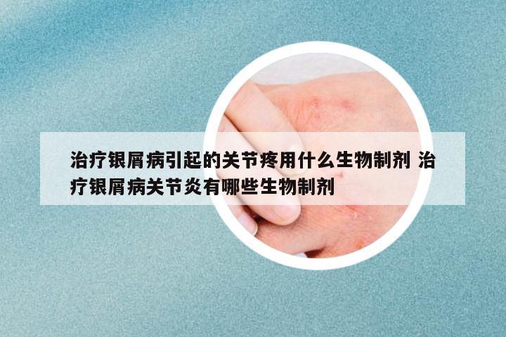 治療銀屑病引起的關(guān)節(jié)疼用什么生物制劑 治療銀屑病關(guān)節(jié)炎有哪些生物制劑
