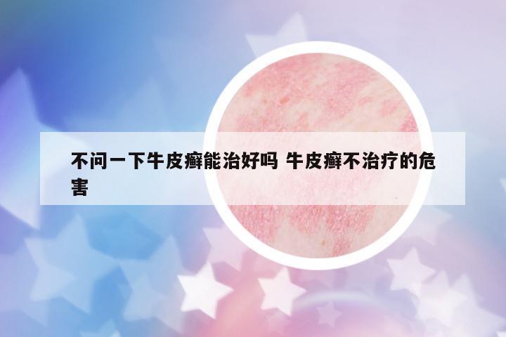 不問(wèn)一下牛皮癬能治好嗎 牛皮癬不治療的危害