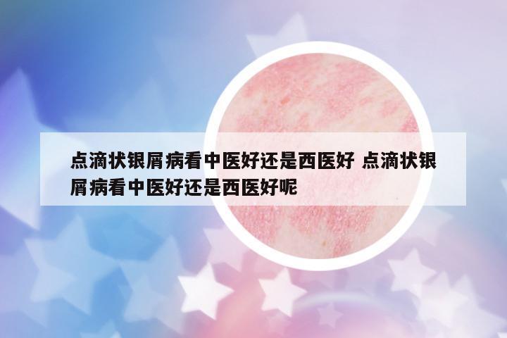 點滴狀銀屑病看中醫(yī)好還是西醫(yī)好 點滴狀銀屑病看中醫(yī)好還是西醫(yī)好呢