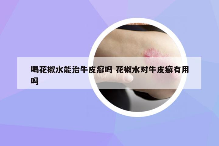 喝花椒水能治牛皮癬嗎 花椒水對牛皮癬有用嗎
