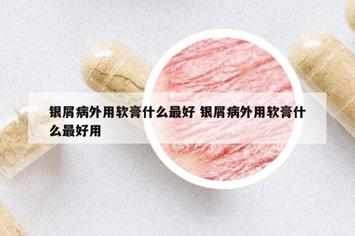 銀屑病外用軟膏什么最好 銀屑病外用軟膏什么最好用