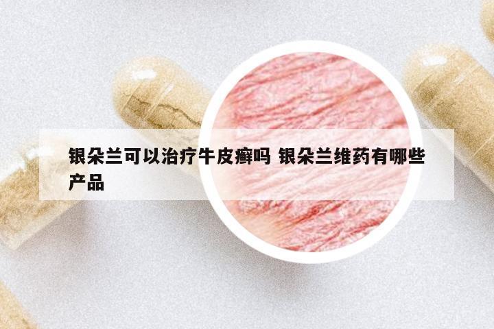 銀朵蘭可以治療牛皮癬嗎 銀朵蘭維藥有哪些產(chǎn)品