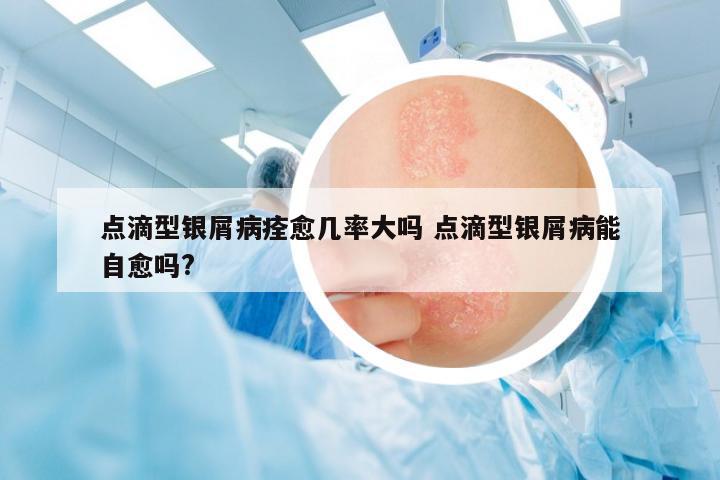 點滴型銀屑病痊愈幾率大嗎 點滴型銀屑病能自愈嗎?
