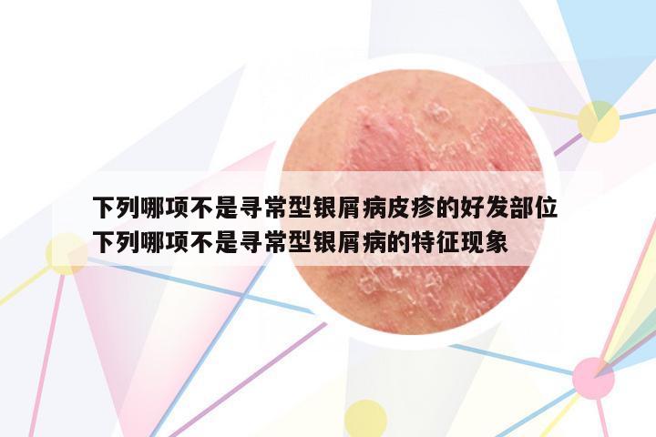 下列哪項(xiàng)不是尋常型銀屑病皮疹的好發(fā)部位 下列哪項(xiàng)不是尋常型銀屑病的特征現(xiàn)象