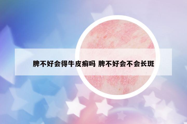 脾不好會得牛皮癬嗎 脾不好會不會長斑