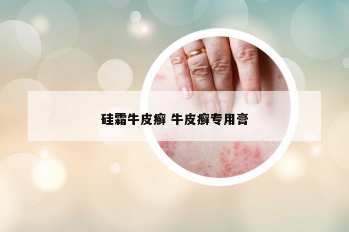 硅霜牛皮癬 牛皮癬專用膏