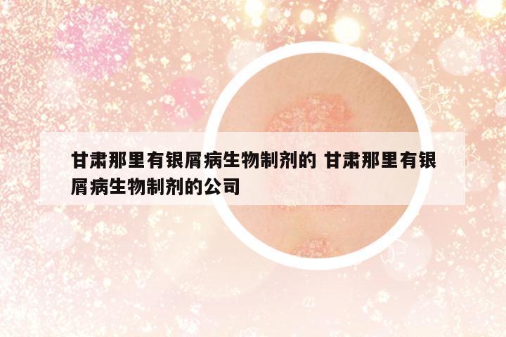 甘肅那里有銀屑病生物制劑的 甘肅那里有銀屑病生物制劑的公司