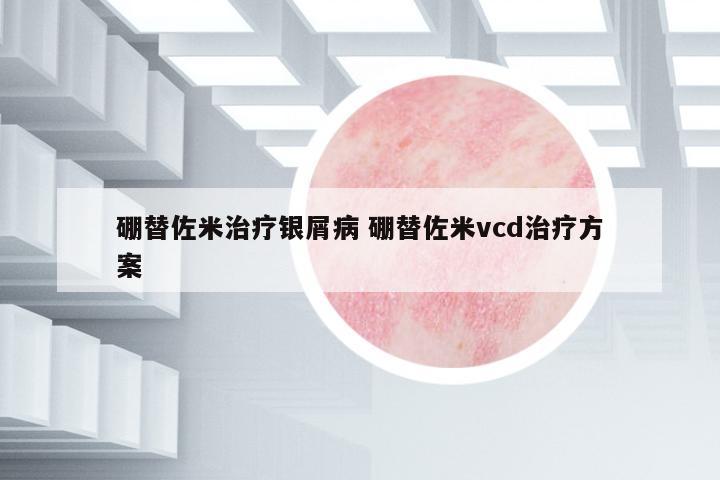 硼替佐米治療銀屑病 硼替佐米vcd治療方案