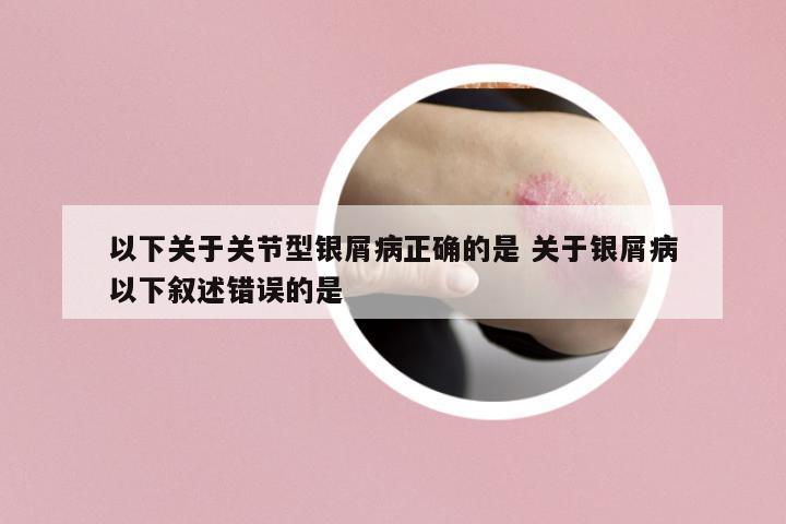 以下關(guān)于關(guān)節(jié)型銀屑病正確的是 關(guān)于銀屑病以下敘述錯(cuò)誤的是