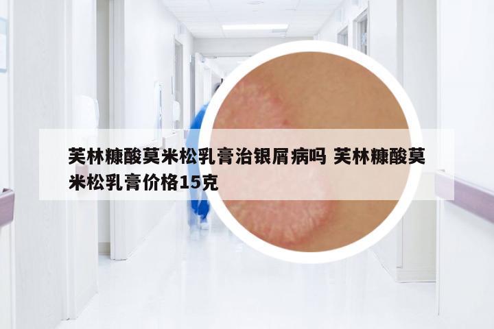 芙林糠酸莫米松乳膏治銀屑病嗎 芙林糠酸莫米松乳膏價格15克