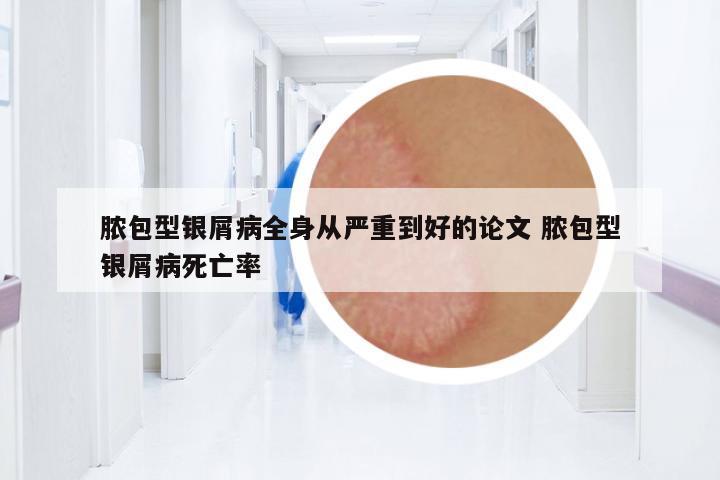 膿包型銀屑病全身從嚴重到好的論文 膿包型銀屑病死亡率