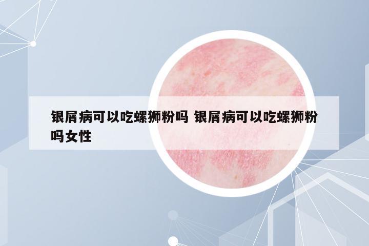 銀屑病可以吃螺獅粉嗎 銀屑病可以吃螺獅粉嗎女性