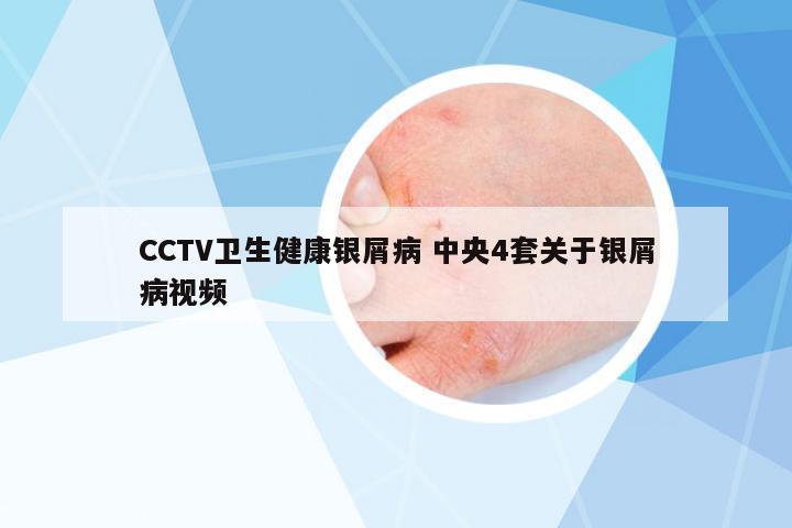 CCTV衛(wèi)生健康銀屑病 中央4套關于銀屑病視頻