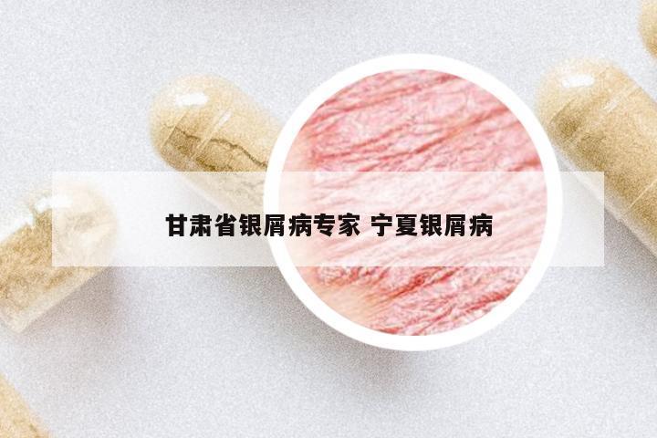 甘肅省銀屑病專家 寧夏銀屑病