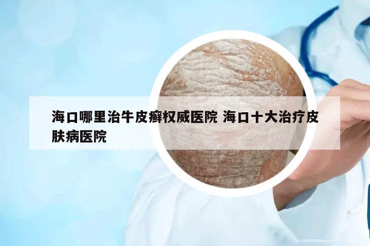 ??谀睦镏闻Fぐ_權威醫(yī)院 海口十大治療皮膚病醫(yī)院
