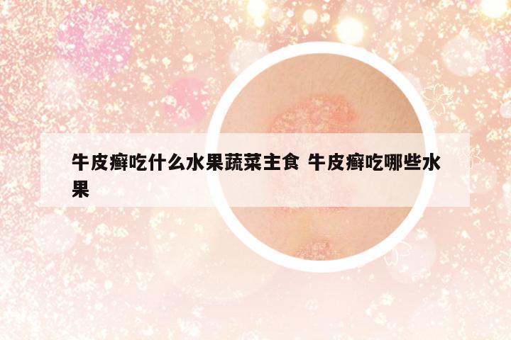 牛皮癬吃什么水果蔬菜主食 牛皮癬吃哪些水果