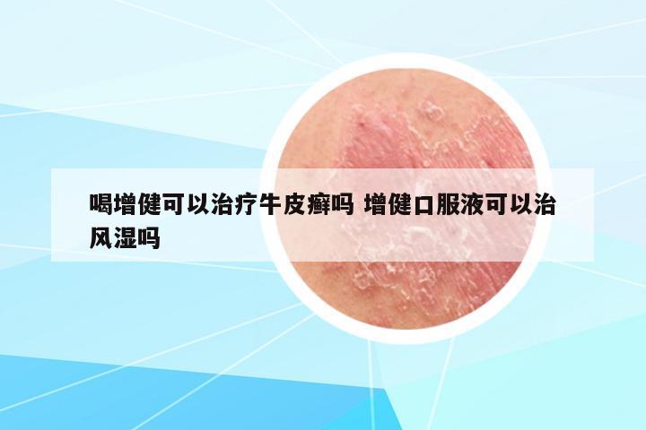 喝增健可以治療牛皮癬嗎 增健口服液可以治風濕嗎