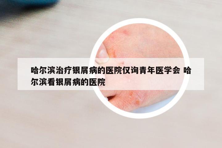 哈爾濱治療銀屑病的醫(yī)院僅詢青年醫(yī)學(xué)會(huì) 哈爾濱看銀屑病的醫(yī)院