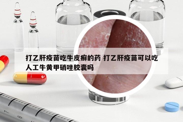打乙肝疫苗吃牛皮癬的藥 打乙肝疫苗可以吃人工牛黃甲硝唑膠囊嗎