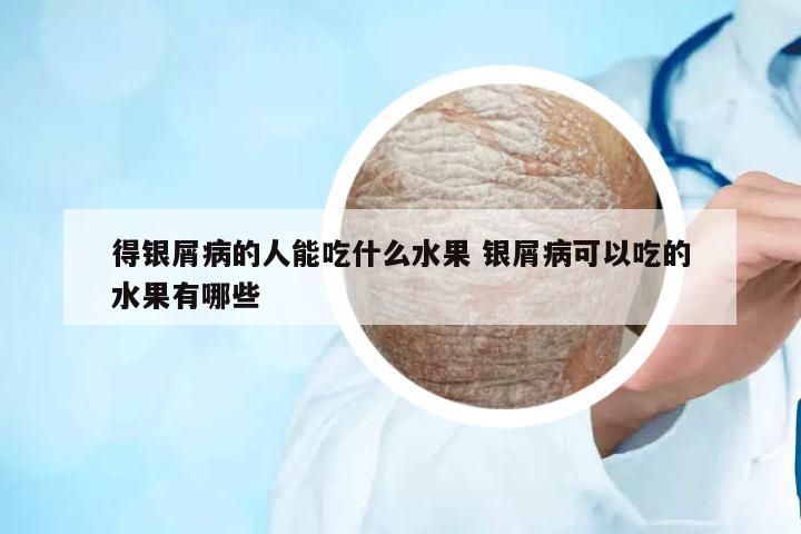 得銀屑病的人能吃什么水果 銀屑病可以吃的水果有哪些