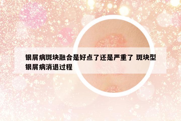 銀屑病斑塊融合是好點了還是嚴重了 斑塊型銀屑病消退過程