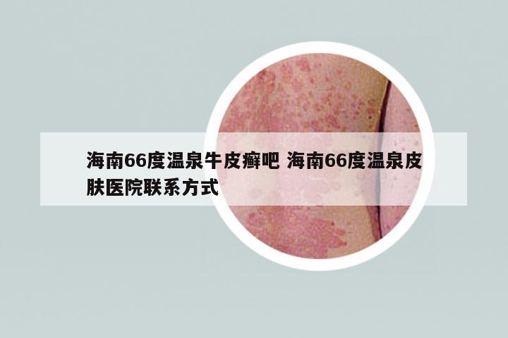 海南66度溫泉牛皮癬吧 海南66度溫泉皮膚醫(yī)院聯(lián)系方式
