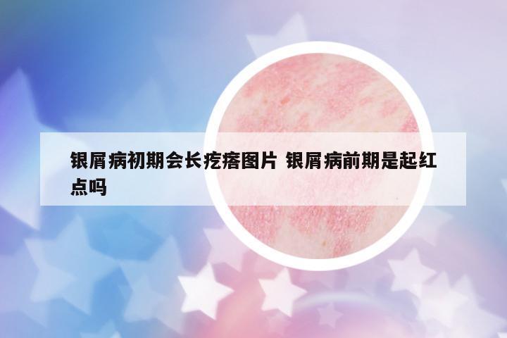 銀屑病初期會長疙瘩圖片 銀屑病前期是起紅點嗎