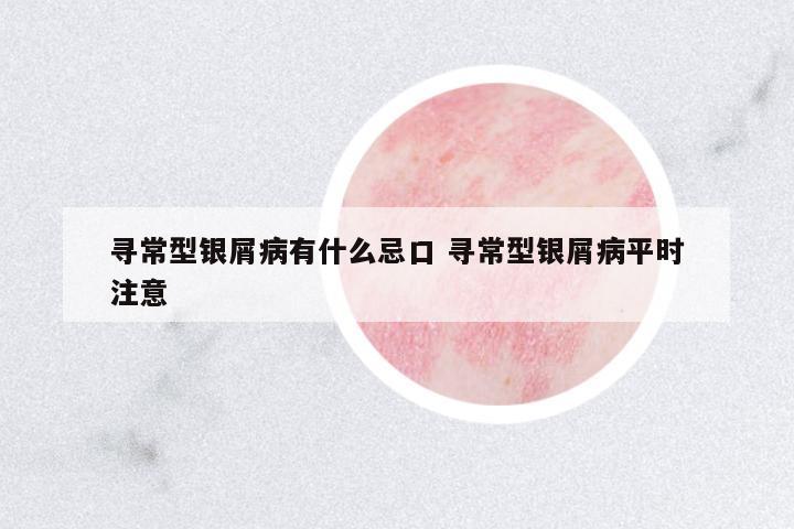 尋常型銀屑病有什么忌口 尋常型銀屑病平時注意