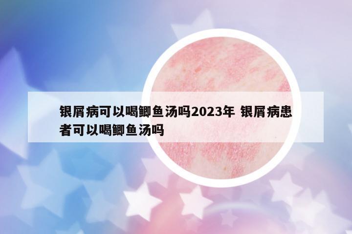 銀屑病可以喝鯽魚湯嗎2023年 銀屑病患者可以喝鯽魚湯嗎