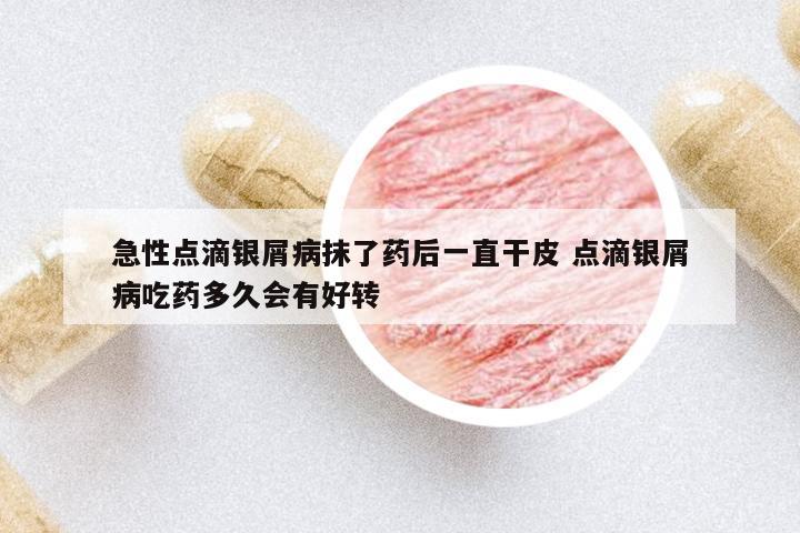 急性點(diǎn)滴銀屑病抹了藥后一直干皮 點(diǎn)滴銀屑病吃藥多久會有好轉(zhuǎn)