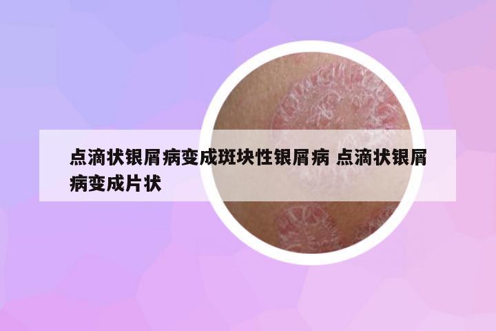 點滴狀銀屑病變成斑塊性銀屑病 點滴狀銀屑病變成片狀