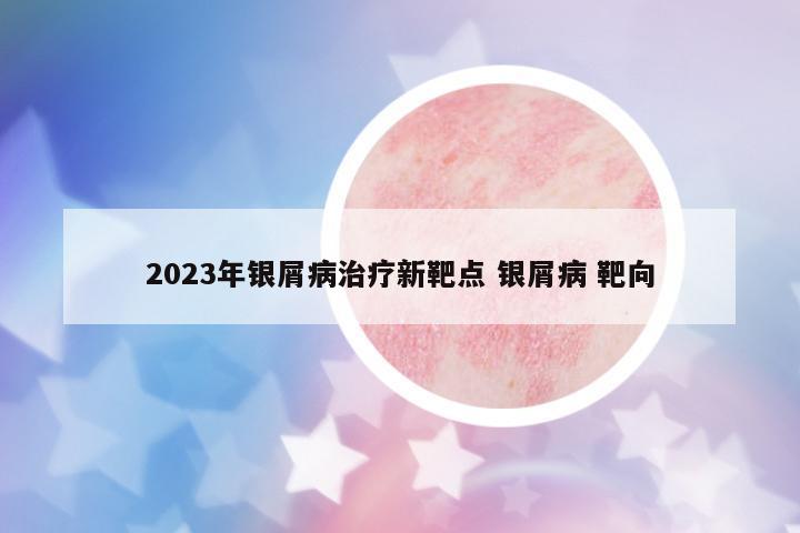 2023年銀屑病治療新靶點(diǎn) 銀屑病 靶向