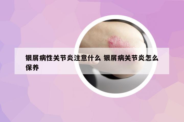 銀屑病性關(guān)節(jié)炎注意什么 銀屑病關(guān)節(jié)炎怎么保養(yǎng)