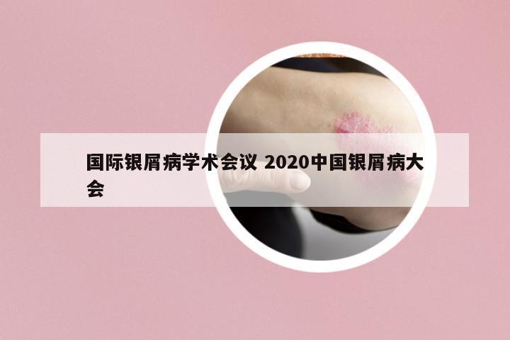 國際銀屑病學(xué)術(shù)會(huì)議 2020中國銀屑病大會(huì)