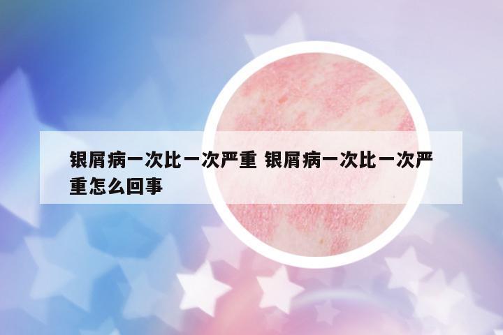銀屑病一次比一次嚴(yán)重 銀屑病一次比一次嚴(yán)重怎么回事