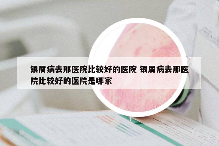 銀屑病去那醫(yī)院比較好的醫(yī)院 銀屑病去那醫(yī)院比較好的醫(yī)院是哪家