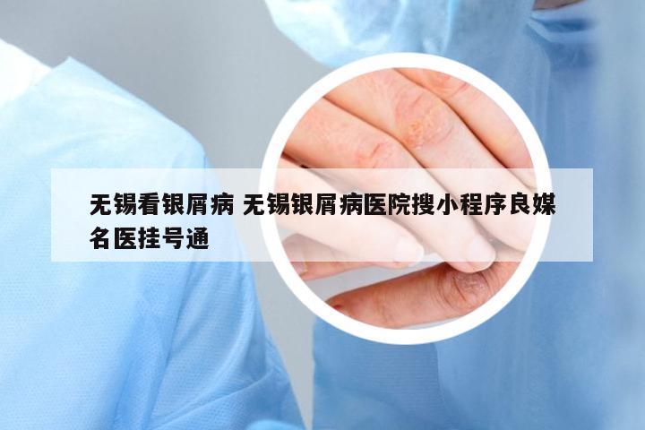 無錫看銀屑病 無錫銀屑病醫(yī)院搜小程序良媒名醫(yī)掛號通