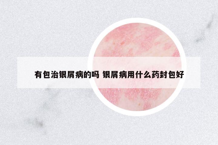 有包治銀屑病的嗎 銀屑病用什么藥封包好