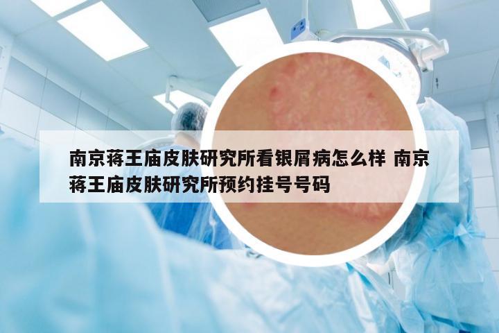 南京蔣王廟皮膚研究所看銀屑病怎么樣 南京蔣王廟皮膚研究所預(yù)約掛號號碼