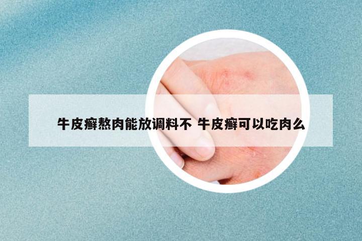牛皮癬熬肉能放調(diào)料不 牛皮癬可以吃肉么