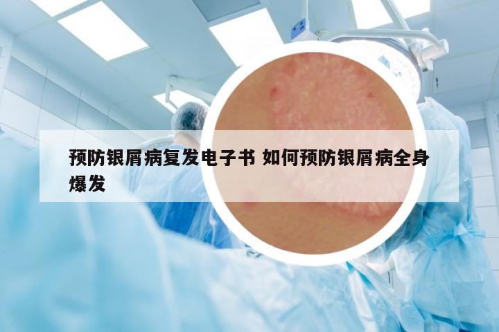 預(yù)防銀屑病復(fù)發(fā)電子書 如何預(yù)防銀屑病全身爆發(fā)