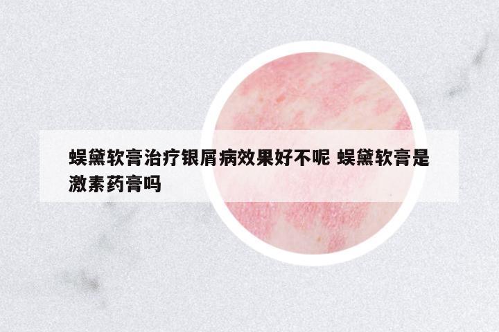 蜈黛軟膏治療銀屑病效果好不呢 蜈黛軟膏是激素藥膏嗎