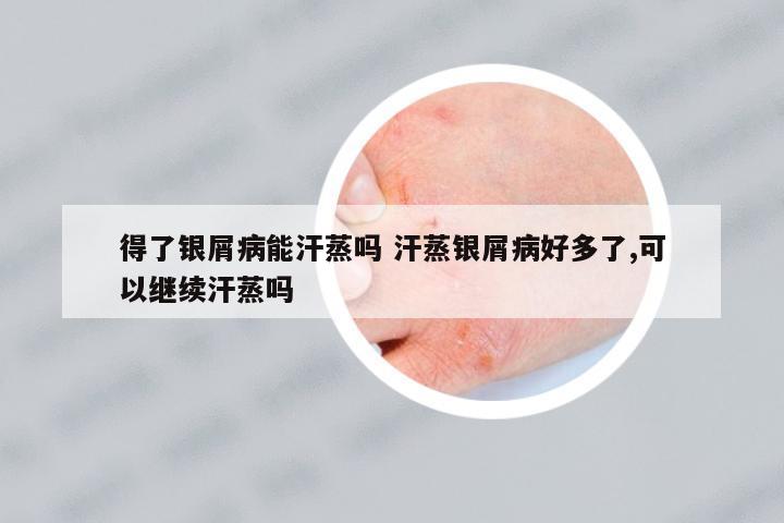 得了銀屑病能汗蒸嗎 汗蒸銀屑病好多了,可以繼續(xù)汗蒸嗎