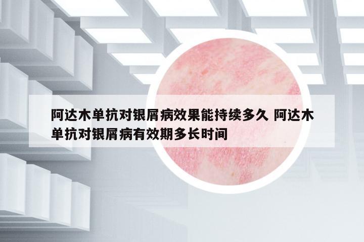 阿達(dá)木單抗對銀屑病效果能持續(xù)多久 阿達(dá)木單抗對銀屑病有效期多長時間