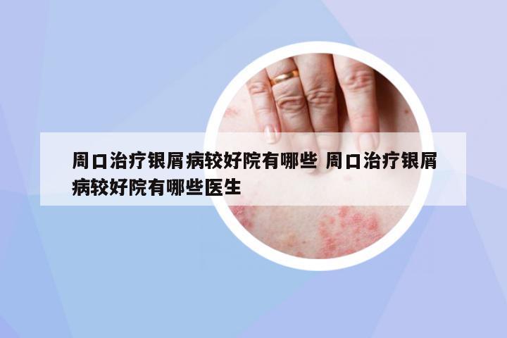 周口治療銀屑病較好院有哪些 周口治療銀屑病較好院有哪些醫(yī)生